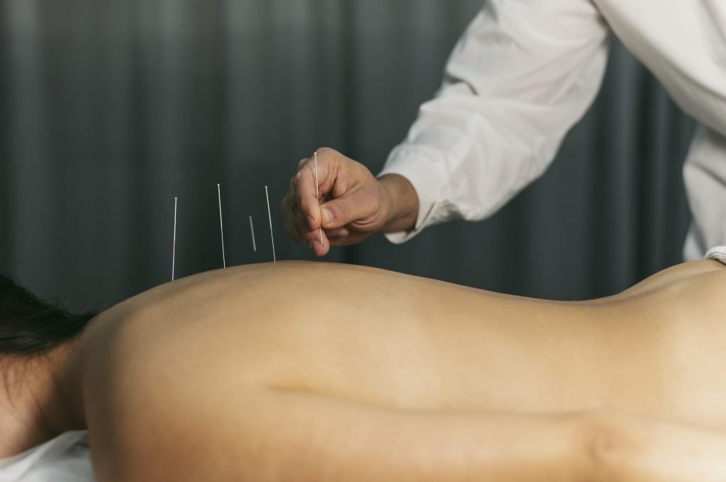 Acupuncturist in Haarlem