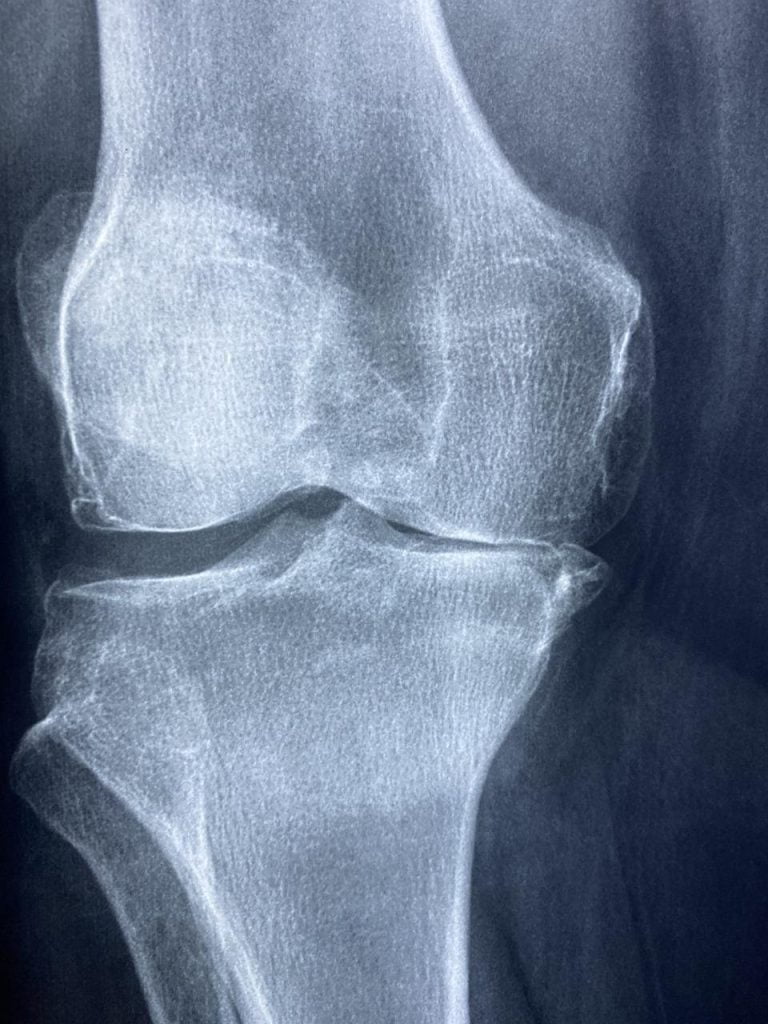 Orthopedie in Haarlem