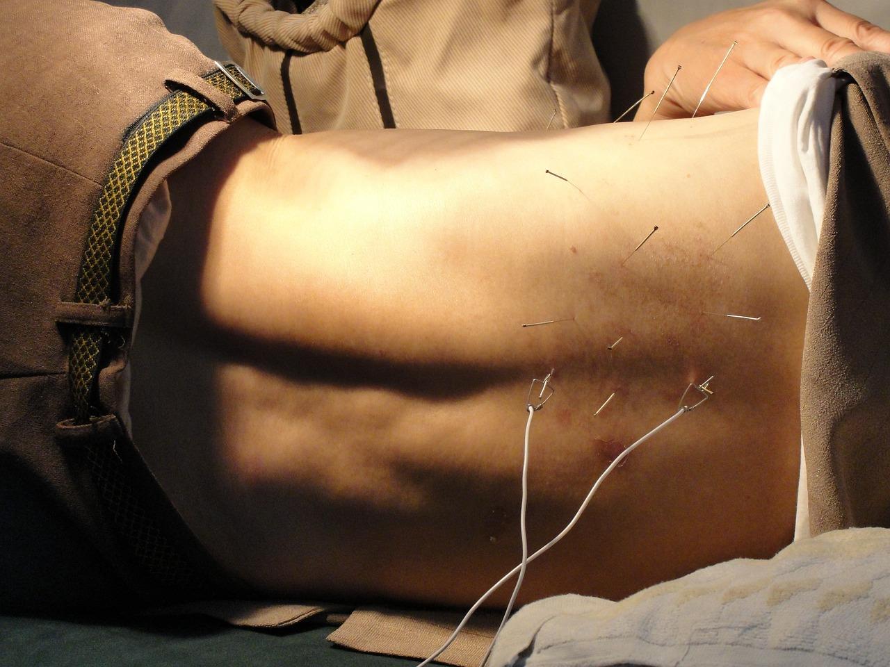 Acupuncturist in Haarlem